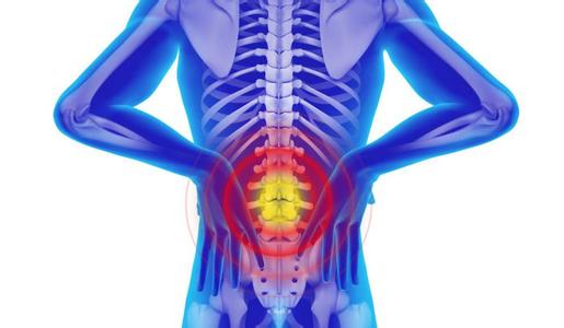 腰椎间盘突出症的饮食安排